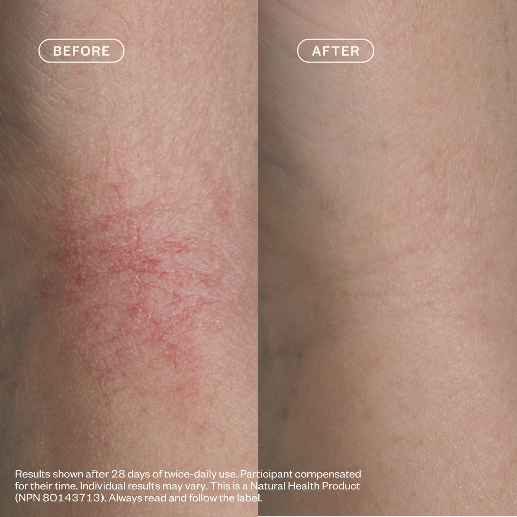Eczema Cleanse & Comfort Ritual C1